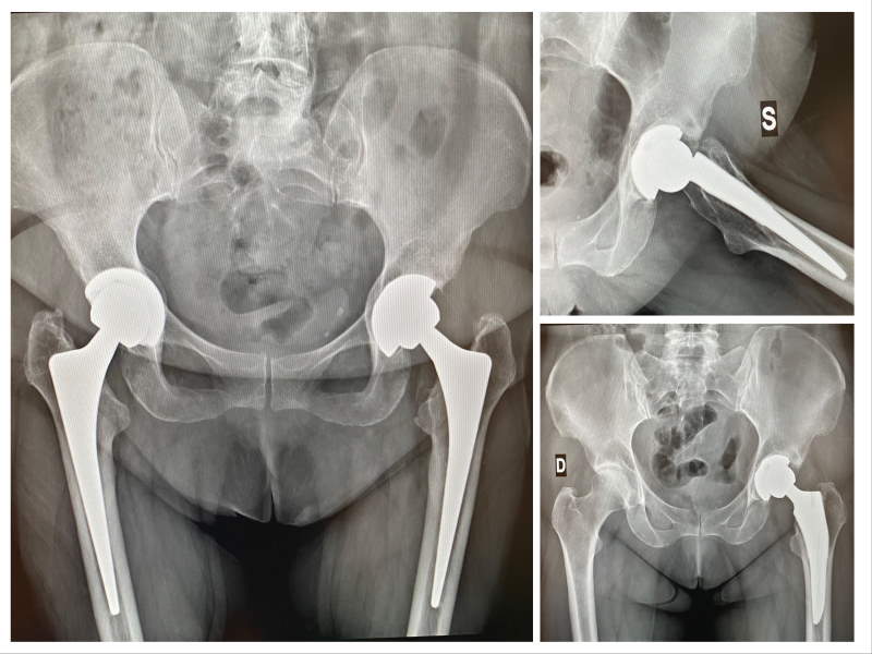 foto post chirurgico