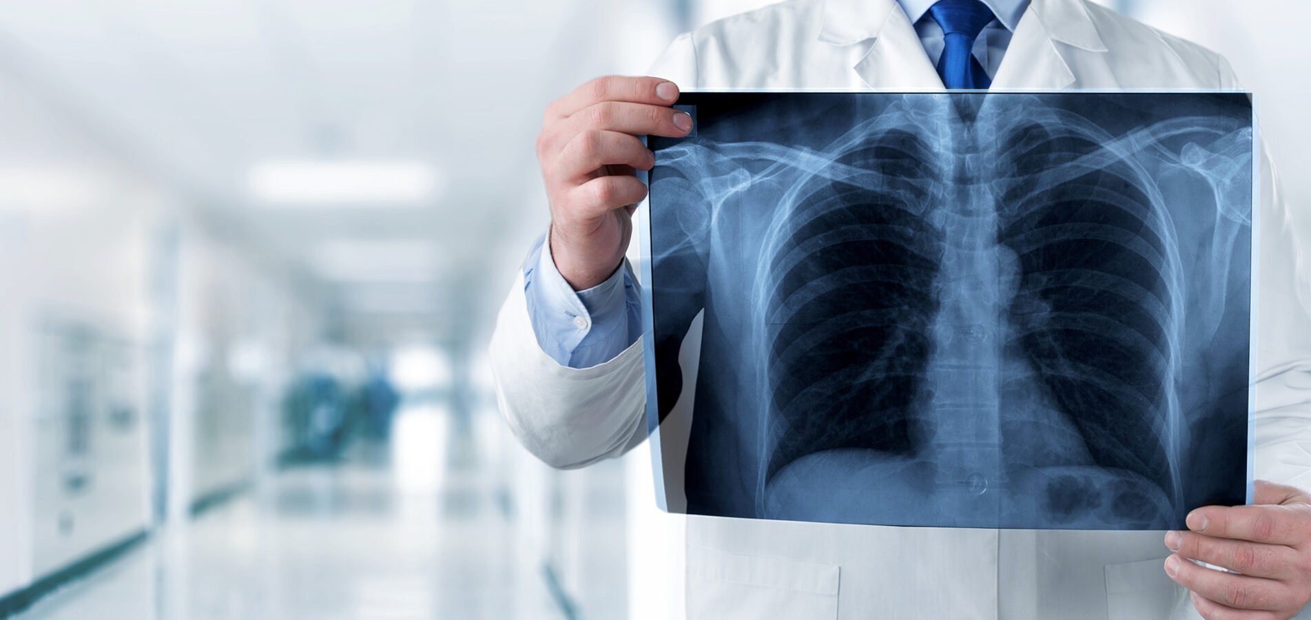 radiografie domicilio roma