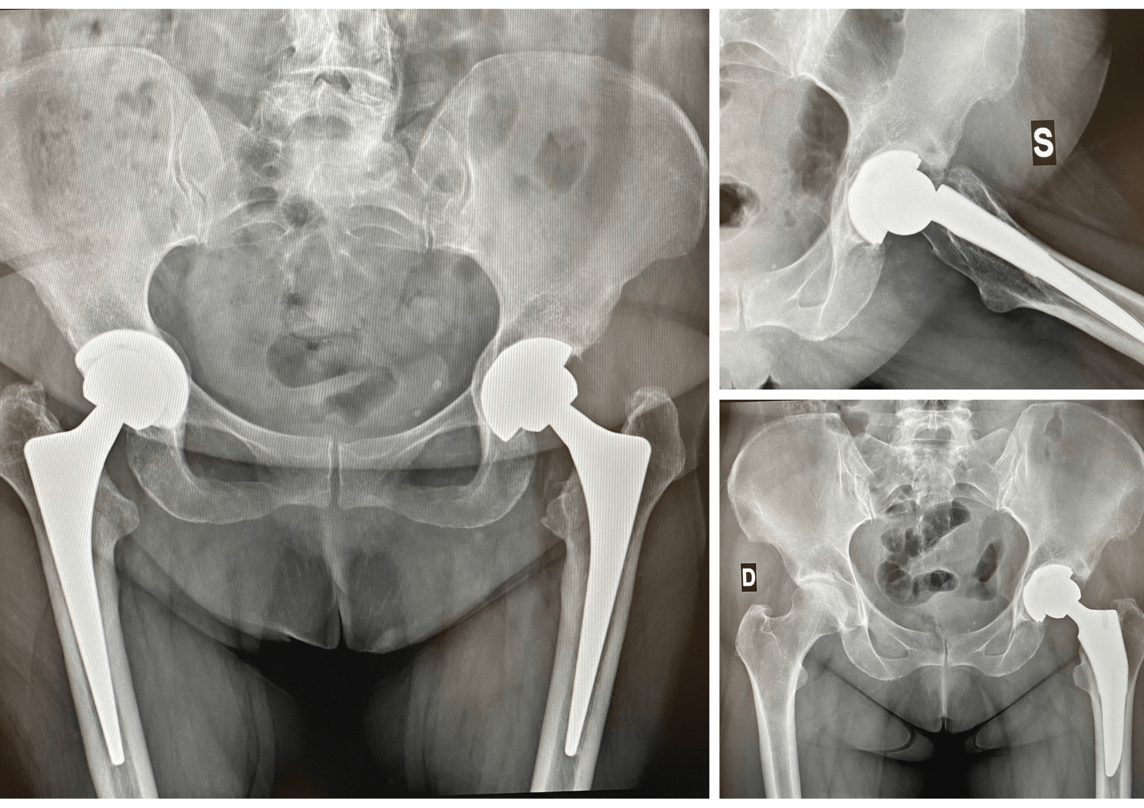 radiografieadomicilioroma - RX 1